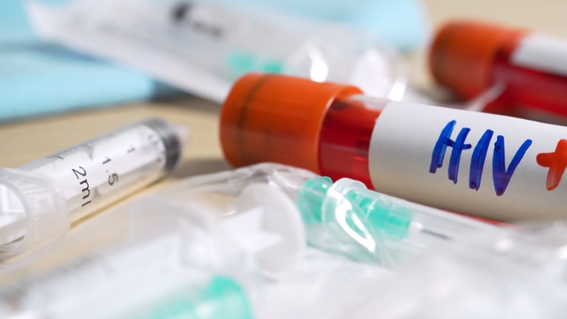 The image shows HIV test tubes and medical supplies for HIV testing