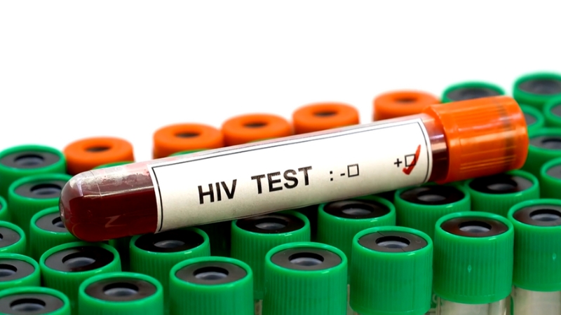 Blood sample labeled "HIV TEST" among several test tubes